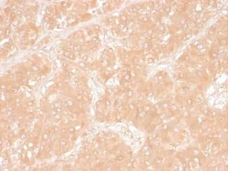 Perilipin-2/ADFP Antibody (ADFP/1366), Novus Biologicals:Antibodies:Primary