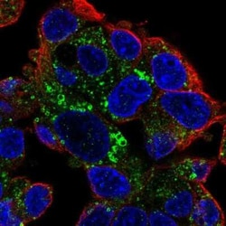 Perilipin-2/ADFP Antibody, Novus Biologicals 25 &mu;L, Unconjugated:Antibodies,