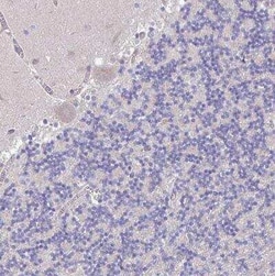 Perilipin-2/ADFP Antibody, Novus Biologicals 25 &mu;L, Unconjugated:Antibodies,