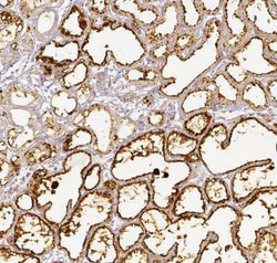 Perilipin-2/ADFP Antibody, Novus Biologicals 25 &mu;L, Unconjugated:Antibodies,