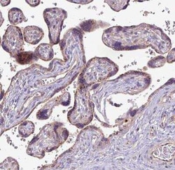 Perilipin-2/ADFP Antibody, Novus Biologicals 25 &mu;L, Unconjugated:Antibodies,