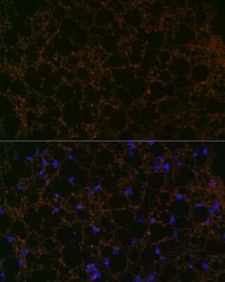 Perilipin Rabbit anti-Mouse, Rat, Clone: 1K4W3, Novus Biologicals 100 &mu;g;