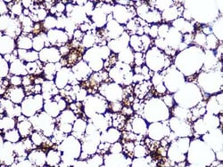 Perilipin Rabbit anti-Mouse, Rat, Clone: 1K4W3, Novus Biologicals 100 &mu;g;
