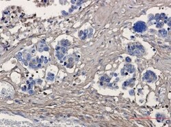 Periostin/OSF-2 Antibody (S03-7E3), Novus Biologicals 50 &mu;g; Unconjugated:Antibodies,