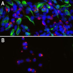 Peripherin Antibody (8G2), Novus Biologicals 100 &mu;L; Unconjugated:Antibodies,