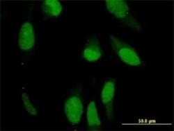 Peripherin Antibody (3B3), Novus Biologicals 0.1 mg | Buy Online | Novus Biologicals | Fisher Scientific