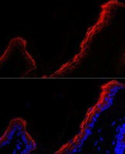 Periplakin Antibody - BSA Free, Novus Biologicals 0.1 mL; Unconjugated:Antibodies,