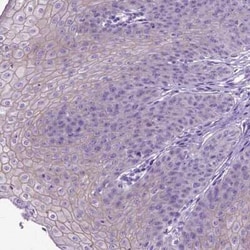 Periplakin Antibody, Novus Biologicals:Antibodies:Primary Antibodies