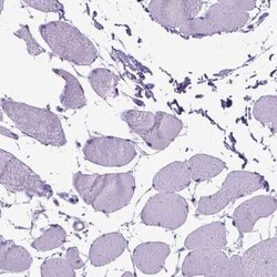 Periplakin Antibody, Novus Biologicals:Antibodies:Primary Antibodies