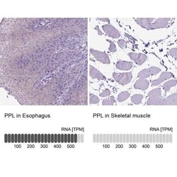 Periplakin Antibody, Novus Biologicals:Antibodies:Primary Antibodies