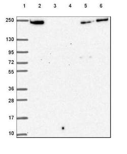 Periplakin Antibody, Novus Biologicals:Antibodies:Primary Antibodies
