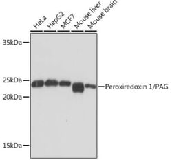 Peroxiredoxin 1 Rabbit anti-Human, Mouse, Clone: 3F8X3, Novus Biologicals 20 &mu;g | Buy Online | Novus Biologicals | Fisher Scientific