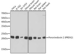 Peroxiredoxin 2 Rabbit anti-Human, Mouse, Rat, Clone: 1U9L9, Novus Biologicals:Antibodies:Primary