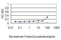 Peroxiredoxin 2 Antibody (4E10-2D2), Novus Biologicals 0.1 mg | Buy Online | Novus Biologicals | Fisher Scientific