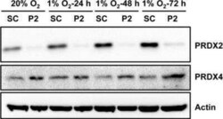Peroxiredoxin 2 Antibody (4E10-2D2), Novus Biologicals 0.1 mg | Buy Online | Novus Biologicals | Fisher Scientific
