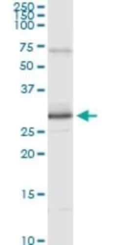 Peroxiredoxin 3 Antibody (1E3-B2), Novus Biologicals 0.1 mg | Buy Online | Novus Biologicals | Fisher Scientific