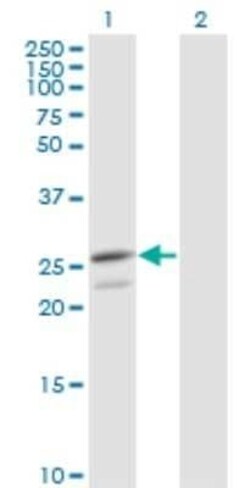 Peroxiredoxin 3 Antibody (1E3-B2), Novus Biologicals 0.1 mg | Buy Online | Novus Biologicals | Fisher Scientific