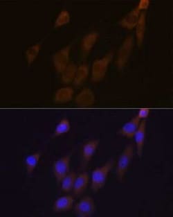 Peroxiredoxin 4 Rabbit anti-Human, Mouse, Rat, Clone: 9E7V0, Novus Biologicals 100 &mu;g | Buy Online | Bio-Techne | Fisher Scientific