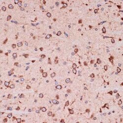 Peroxiredoxin 4 Rabbit anti-Human, Mouse, Rat, Clone: 9E7V0, Novus Biologicals 100 &mu;g | Buy Online | Bio-Techne | Fisher Scientific