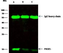 Peroxiredoxin 5 Rabbit anti-Human, Clone: 2, Novus Biologicals 100 &mu;g;