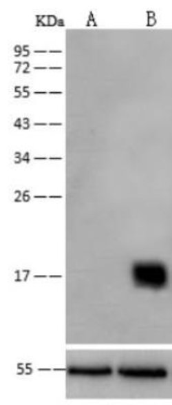 Peroxiredoxin 5 Rabbit anti-Human, Clone: 2, Novus Biologicals 100 &mu;g;