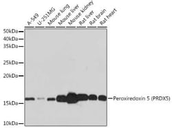 Peroxiredoxin 5 Rabbit anti-Human, Mouse, Rat, Clone: 5E10D3, Novus Biologicals
