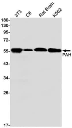 Phenylalanine Hydroxylase Antibody (S06-3H4), Novus Biologicals 100 &mu;g;