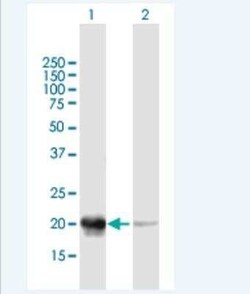 Phosducin Antibody, Novus Biologicals 50 &mu;g | Buy Online | Novus Biologicals | Fisher Scientific