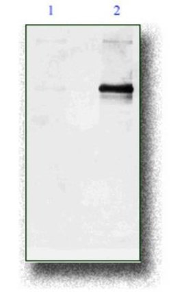 Phosphodiesterase 4A/PDE4A, p Ser686, p Ser688 Antibody, Novus Biologicals