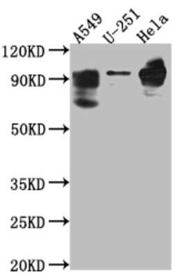 Phosphodiesterase 4D Antibody (4D4), Novus Biologicals 100 &mu;g | Buy Online | Novus Biologicals | Fisher Scientific