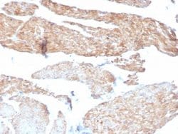 Phosphoglucomutase 5 Antibody (14F8/F8) - Azide and BSA Free, Novus Biologicals 100 &mu;g | Buy Online | Novus Biologicals | Fisher Scientific