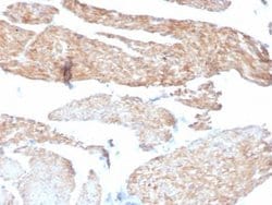Phosphoglucomutase 5 Mouse anti-Human, Mouse, Rat, Bovine, Rabbit, Clone: