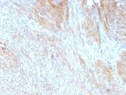 Phosphoglucomutase 5 Mouse anti-Human, Mouse, Rat, Bovine, Rabbit, Clone: