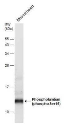 Phospholamban, p Ser16 Antibody, Novus Biologicals 100 &mu;g | Buy Online | Novus Biologicals | Fisher Scientific