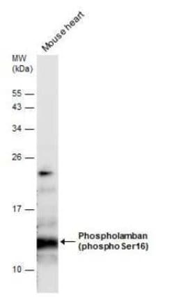 Phospholamban, p Ser16 Antibody, Novus Biologicals 100 &mu;g | Buy Online | Novus Biologicals | Fisher Scientific
