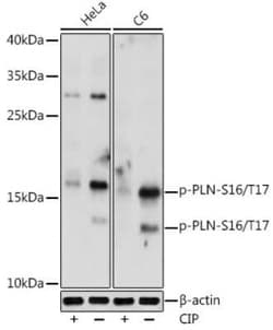 Phospholamban Rabbit anti-Human, Mouse, Rat, Polyclonal, Novus Biologicals