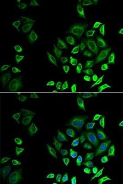 Phospholipase A2 IID Antibody - BSA Free, Novus Biologicals:Antibodies:Primary