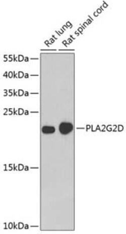 Phospholipase A2 IID Antibody - BSA Free, Novus Biologicals:Antibodies:Primary