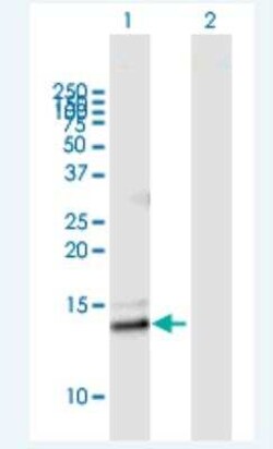 Novus Biologicals Phospholipase A2 IIE Antibody, Novus Biologicals 50 &mu;g | Buy Online | Novus Biologicals&trade; | Fisher Scientific
