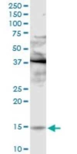 Phospholipase A2 IIE Antibody, Novus Biologicals 0.1 mg | Buy Online | Novus Biologicals | Fisher Scientific