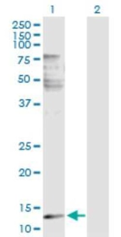 Phospholipase A2 IIE Antibody, Novus Biologicals 0.1 mg | Buy Online | Novus Biologicals | Fisher Scientific
