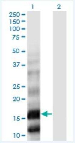 Phospholipase A2 X Antibody (5G11), Novus Biologicals 100 &mu;g | Buy Online | Novus Biologicals | Fisher Scientific