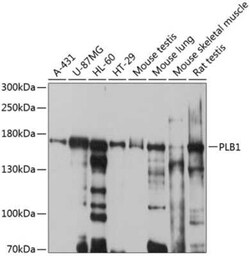 Phospholipase B1 Antibody - BSA Free, Novus Biologicals 0.02 mL, Unconjugated:Antibodies,