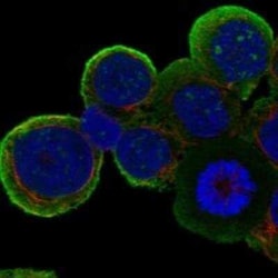 Phospholipase C beta 2 Rabbit anti-Human, Polyclonal, Novus Biologicals:Antibodies:Primary