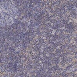 Phospholipase C beta 2 Rabbit anti-Human, Polyclonal, Novus Biologicals:Antibodies:Primary