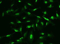 Phospholipase C delta 1 Antibody, Novus Biologicals 50 &mu;g; Unconjugated:Antibodies,