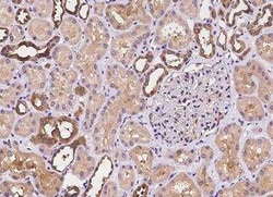 Phospholipase C delta 1 Antibody, Novus Biologicals 50 &mu;g; Unconjugated:Antibodies,