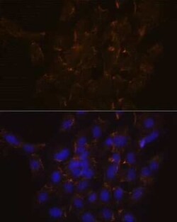Phospholipid Scramblase 1/PLSCR1 Rabbit anti-Human, Mouse, Rat, Clone:
