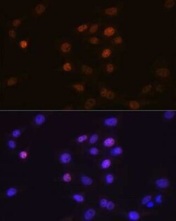 Phospholipid Scramblase 1/PLSCR1 Rabbit anti-Human, Mouse, Rat, Clone: