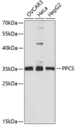 Phosphopantothenate-cysteine ligase Antibody - Azide and BSA Free, Novus